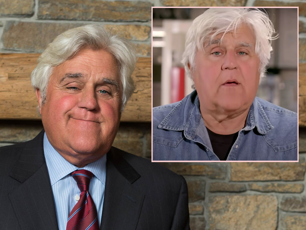 #Jay Leno May Need Skin Grafts After Car Fire That Left Him Badly Burned