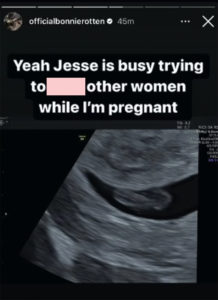 Jesse James BEGS After Pregnant Wife Bonnie Rotten Accuses Him Of