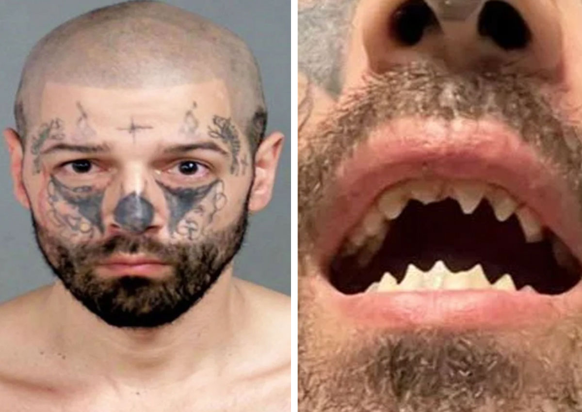 #Woman Held Captive As Sex Slave For Weeks By Terrifying Man With ‘Monster’ Teeth