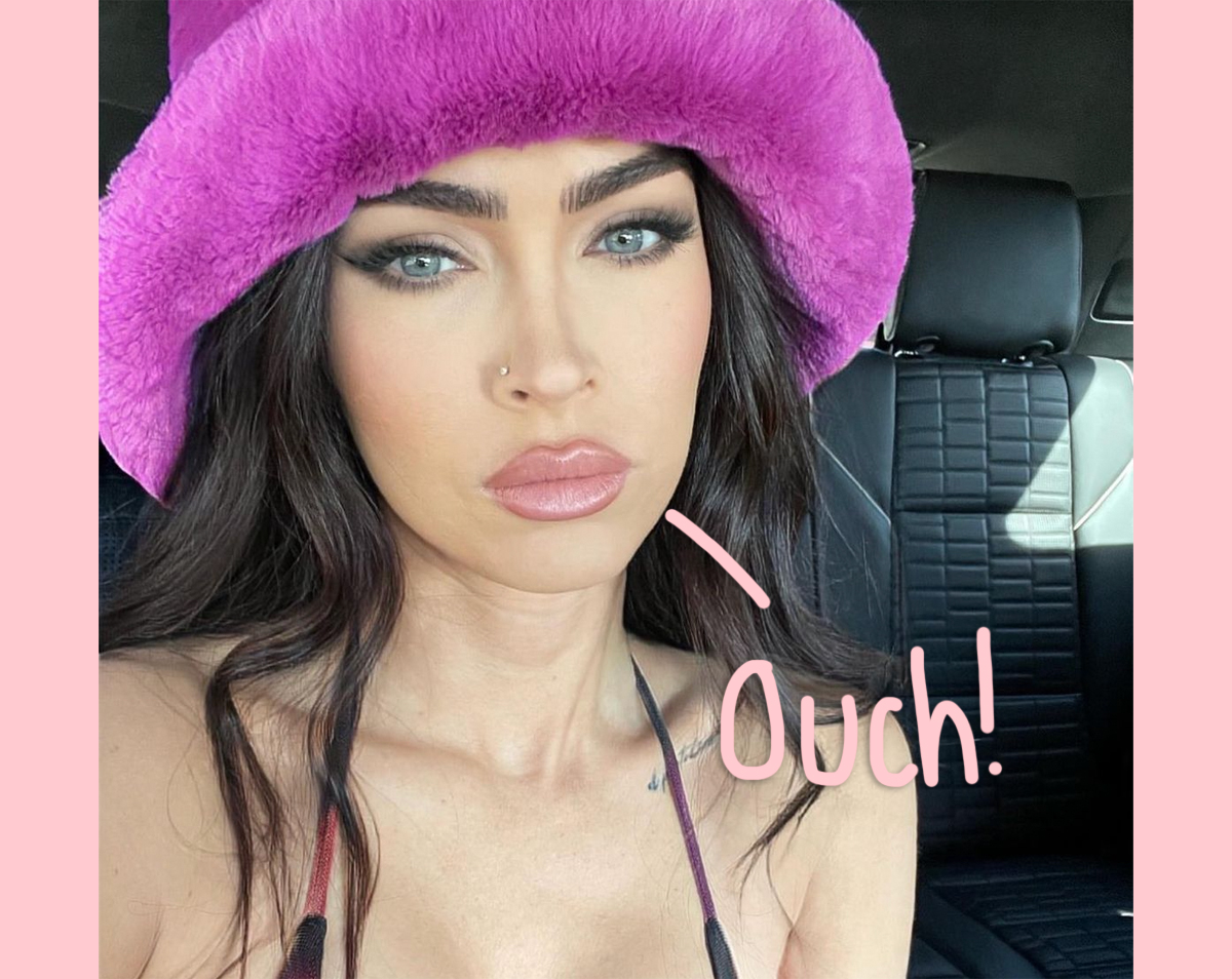 Megan Fox Attended Pre-Grammys Party After Sustaining ‘Broken Wrist’ & ‘Concussion’!