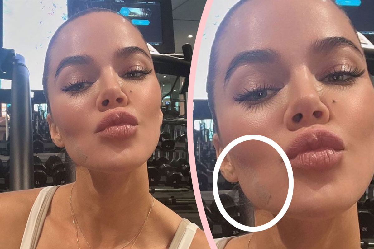 PICS] Khloe Kardashian Vagina Facial -- Top Doctor Slams