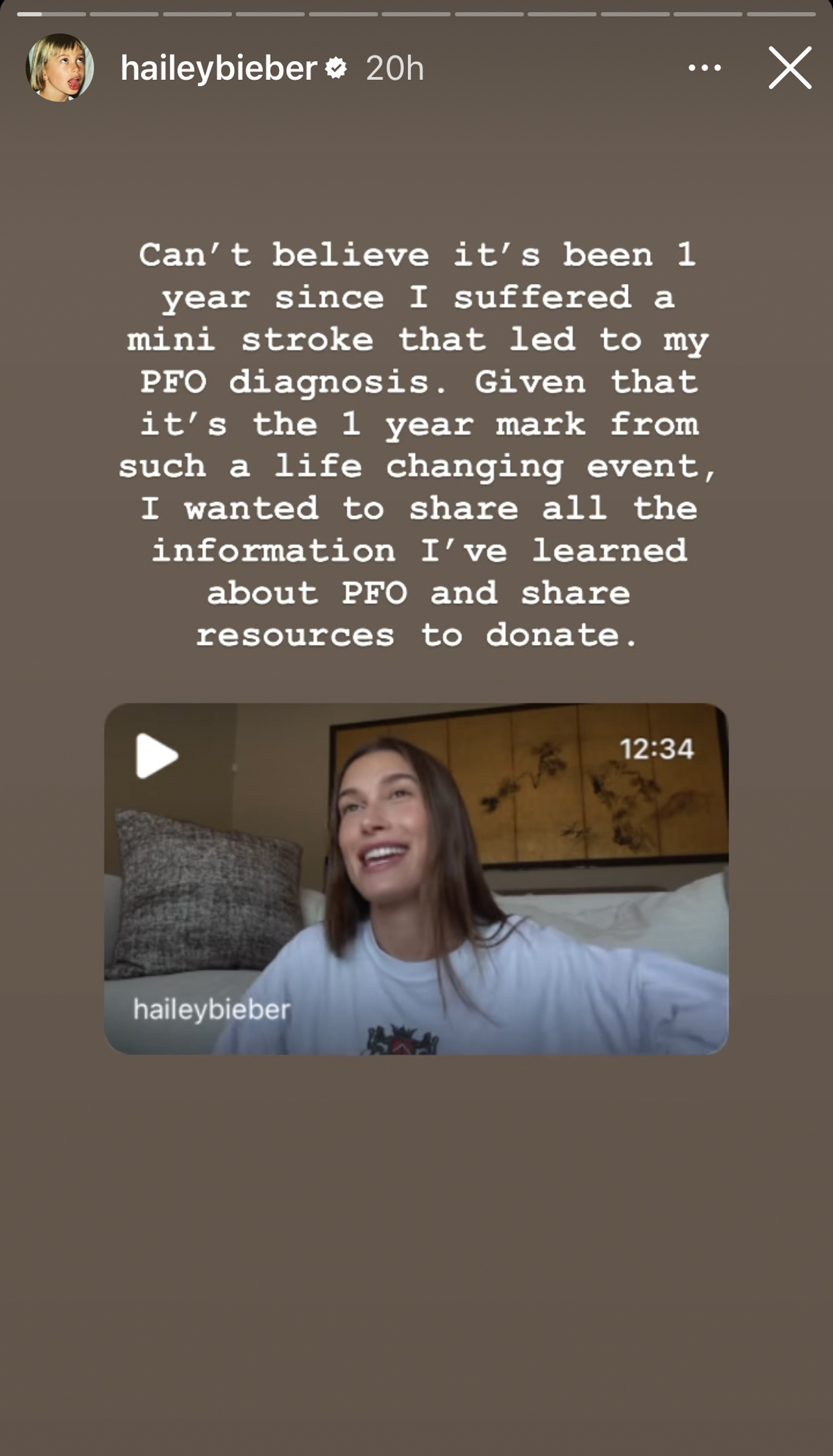 Hailey Bieber Reflects On The One-Year Anniversary Of Her ‘Life-Changing’ Mini-Stroke