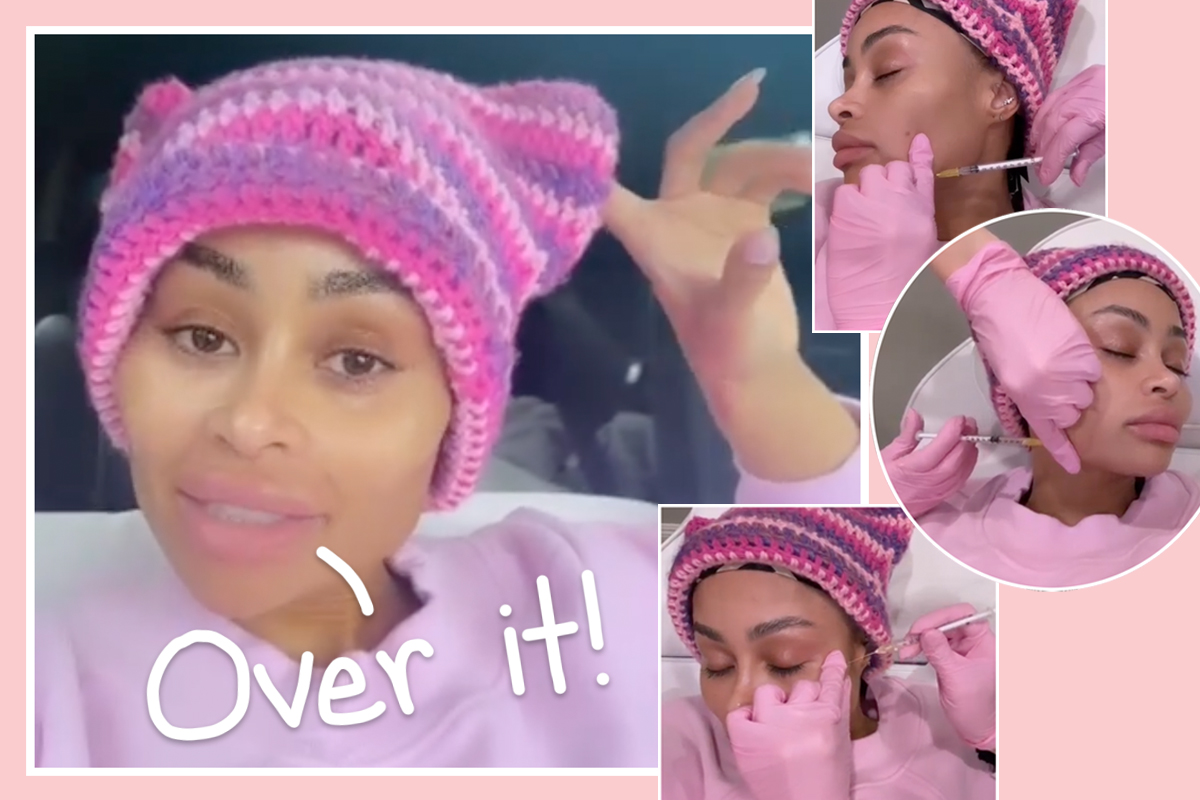 blac chyna removes facial fillers video
