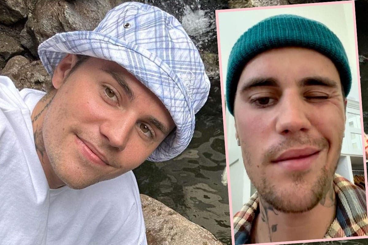 Justin Bieber reveals face mobility following Ramsay Hunt syndrome  diagnosis