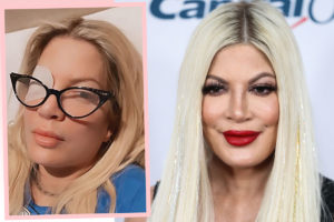 Tori Spelling Left Contact Lenses In For WEEKS - Now She Has A Scary