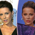 Kate Beckinsale SHUTS DOWN Facelift Accusations From Trolls Who Can't Believe How She's Aging!