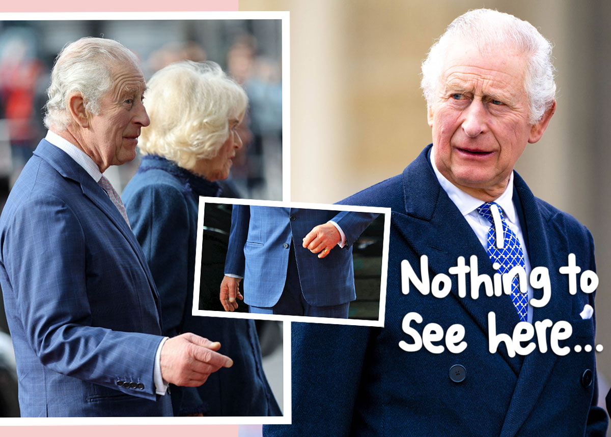 Was King Charles ‘bullied Into Hiding His ‘sausage Fingers In New 