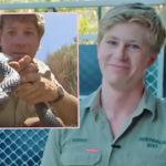 Steve Irwin’s Son Is Just Like His Late Dad -- Matching Gruesome Snake Bites!