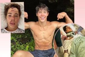 TikTok Star Caleb Coffee In ICU After Falling From ‘60 To 80-Foot