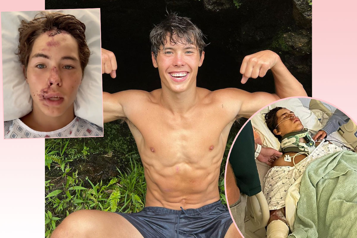 TikTok Star Caleb Coffee In ICU After Falling From ‘60 To 80-Foot ...