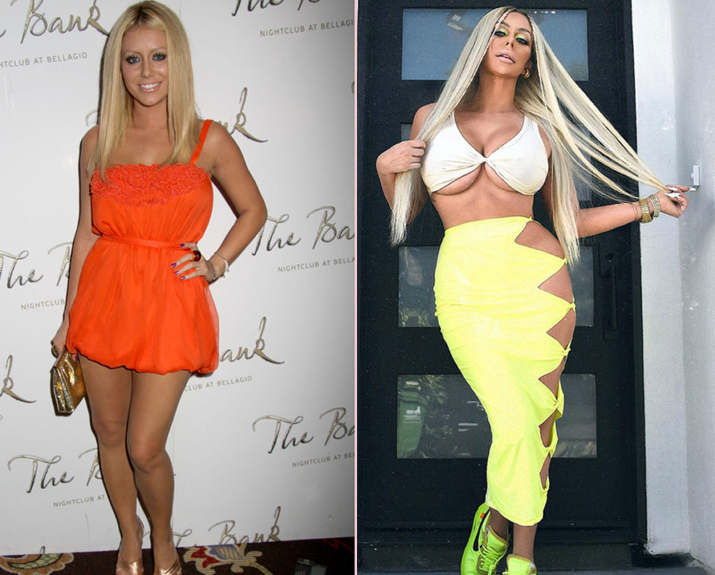 Aubrey O Day Reveals Which Cosmetic Surgery She s Gotten And