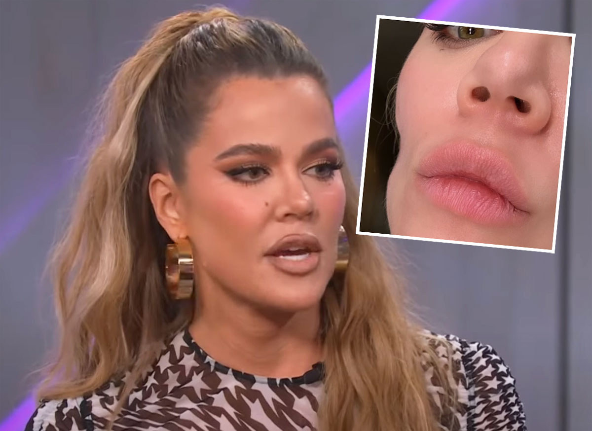 Khloé Kardashian Gets Candid About Cheek Indention Left By Skin Cancer Scare
