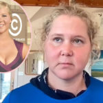 Amy Schumer Shares Shocking Before & After Pics -- Warning '20 Somethings' That 'Life Is Coming'!