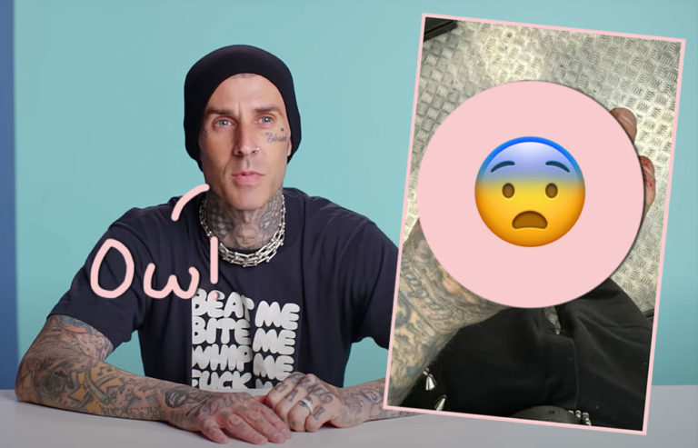 Travis Barker Shares Gruesome Pic Of Hand Injury After UK Blink-182 ...