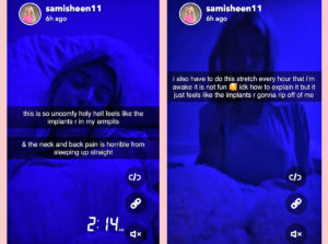 Sami Sheen Got The Boob Job! And She's Sharing The Entire Journey On