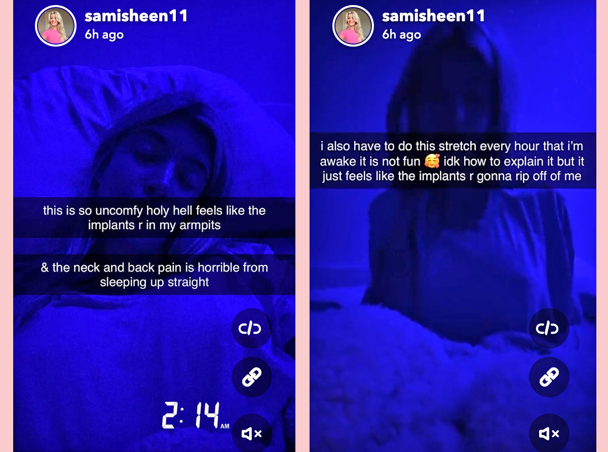 Sami Sheen Got The Boob Job! And She's Sharing The Entire Journey On Social  Media! - Perez Hilton