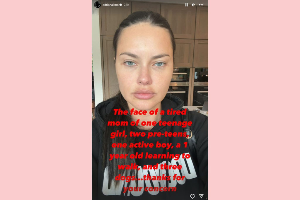 Adriana Lima Hits Back With Surprising Explanation After Fans Wonder If ...