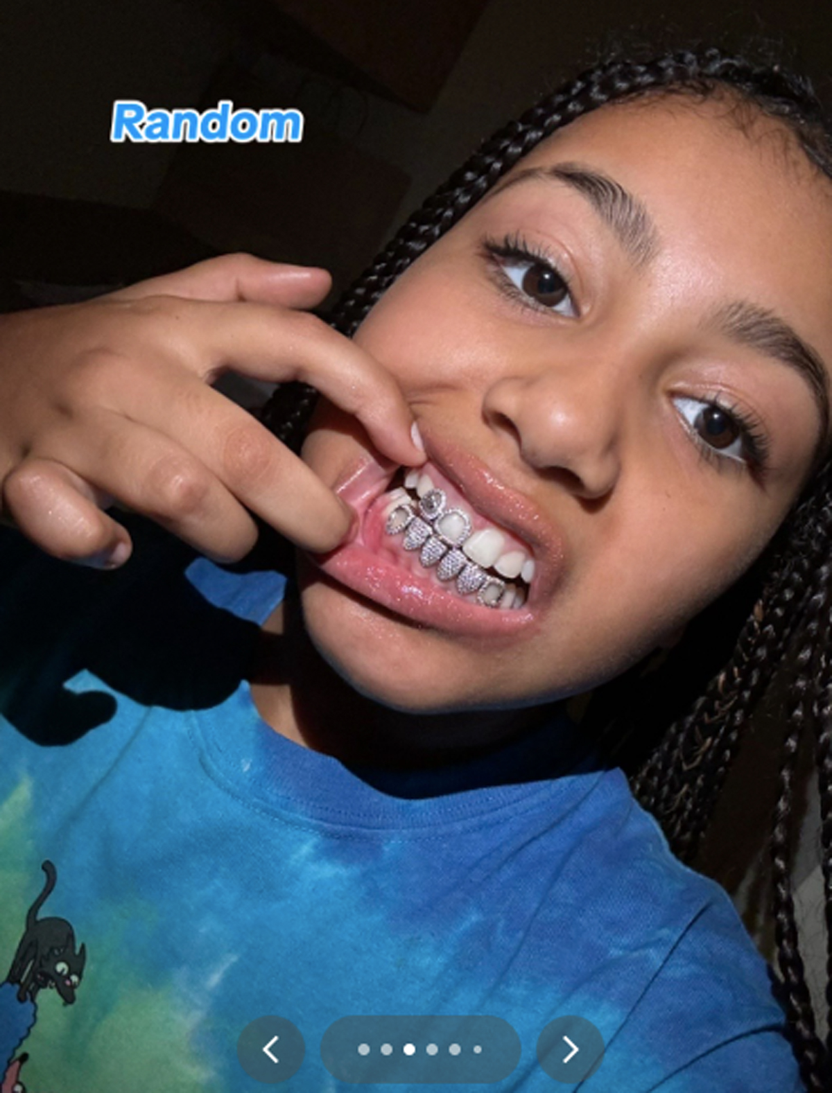 North West Reveals She Got Diamond Grills After Dad Kanye Debuted Titanium Teeth! 