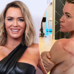 Teddi Mellencamp Shows Off Huge Scar After Melanoma Successfully Removed In Surgery!