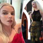 Fans Say Anya Taylor-Joy Is 'Promoting Starvation' In Topless Corset Pic!