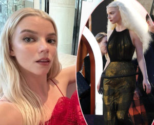 Fans Say Anya Taylor-Joy Is 'Promoting Starvation' In Topless Corset