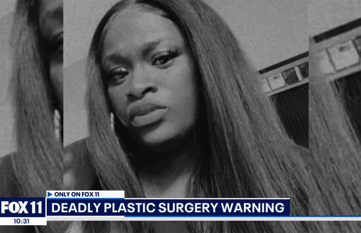 #30-Year-Old Woman Dies From Complications Of ‘Mommy Makeover’ Discount Surgery In Mexico!