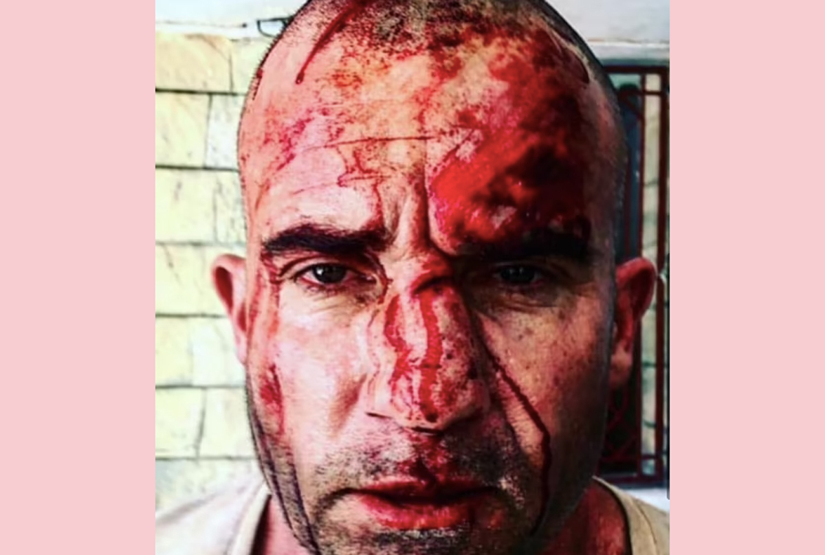 Tish Cyrus’ Husband Dominic Purcell Show Off Bloodied Face Following On-Set Accident In Pic! 