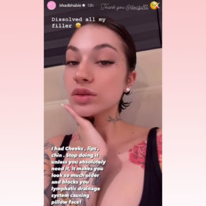 Bhad Bhabie Dissolved All Her Filler! See Her Natural New Look! - Perez