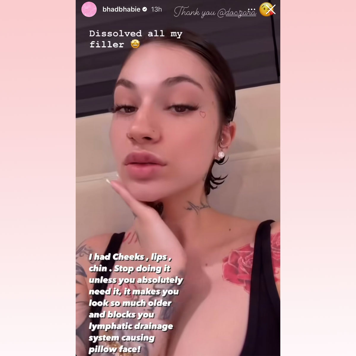 Bhad Bhabie Dissolved All Her Filler! See Her Natural New Look!