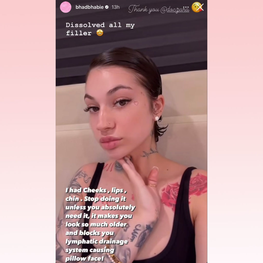 Bhad Bhabie Dissolved All Her Filler! See Her Natural New Look! - Perez ...