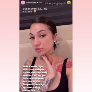 Bhad Bhabie Dissolved All Her Filler! See Her Natural New Look! - Perez