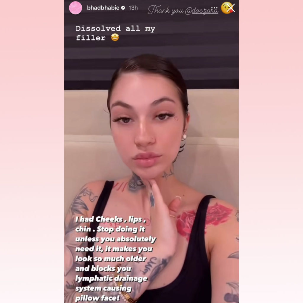 Bhad Bhabie Dissolved All Her Filler! See Her Natural New Look! - Perez ...