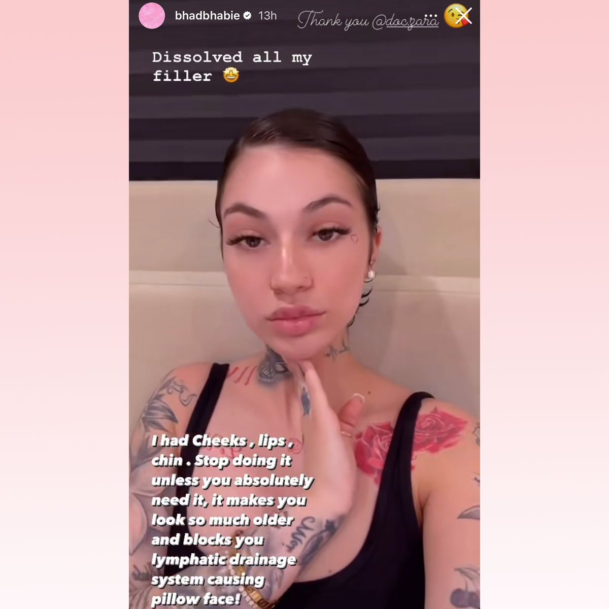 Bhad Bhabie Dissolved All Her Filler!