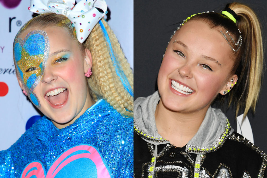 JoJo Siwa Spent $50K On THIS Cosmetic Procedure! Can You Even Tell ...