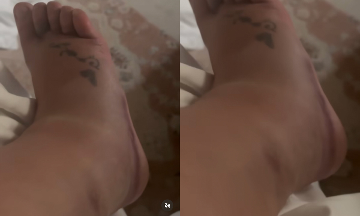 Britney Spears Shares New Video Of 'Really Swollen’ Foot