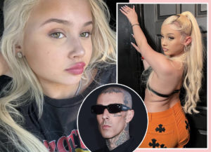 Alabama Barker Should NOT Take Weight Loss Medication, Says Expert