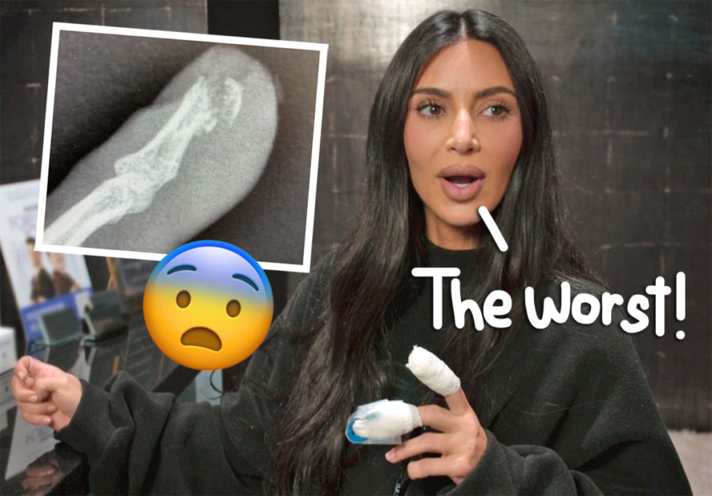 Kim Kardashian Says She 'Wanted To Die' After Gruesome Finger Injury ...