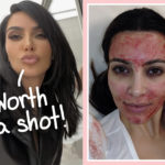 Hold Her Beer, Vampire Facial! Kim Kardashian Just Got WHAT Injected Into Her Face?!?!