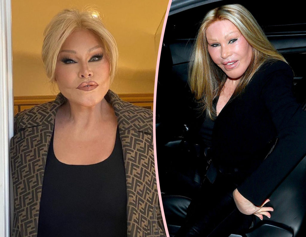 ‘Catwoman’ Socialite Jocelyn Wildenstein Reveals Pre-Surgery Face In ...