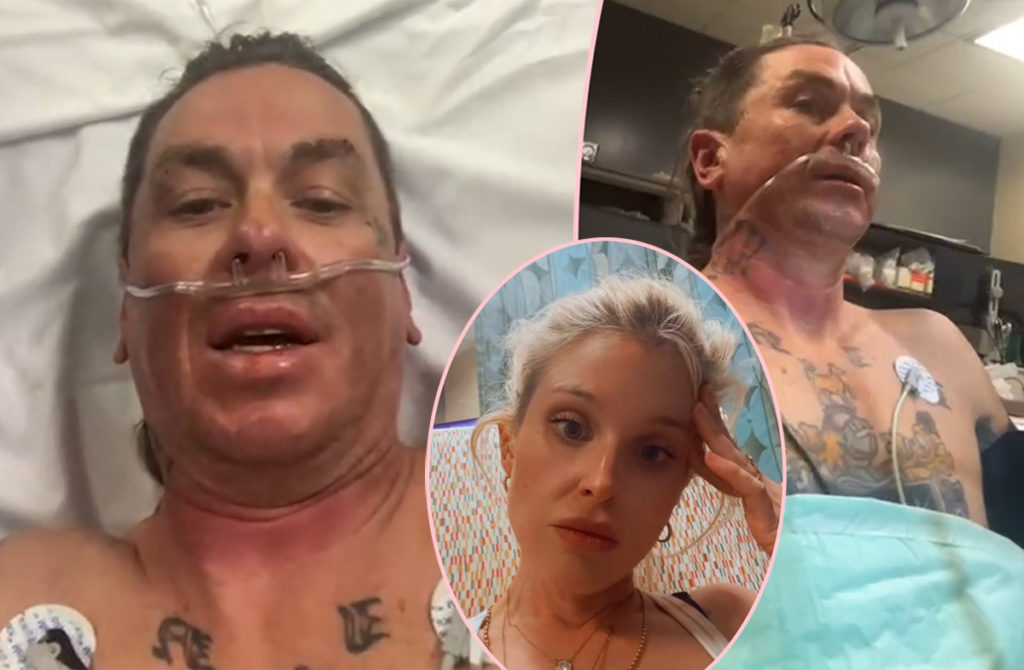 Kelly Osbourne’s Boyfriend Sid Wilson Hospitalized With Severe Burns After He ‘Set Himself On Fire’ In Scary Farm Accident!