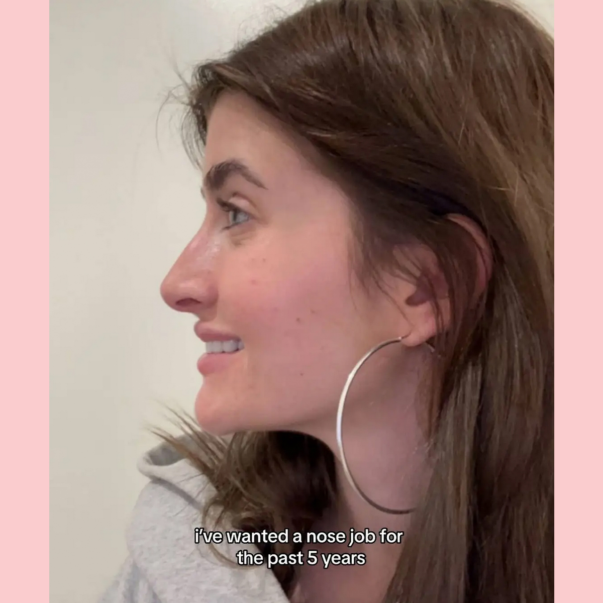 Sami Sheen Got A Nose Job - And Is Documenting Every Step On TikTok ...