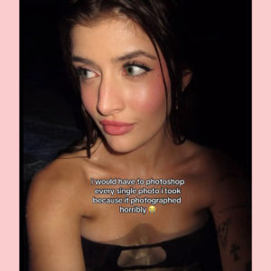 Sami Sheen Got A Nose Job - And Is Documenting Every Step On TikTok