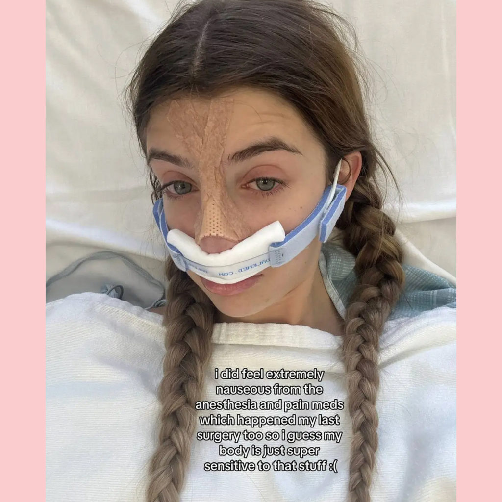 Sami Sheen Got A Nose Job - And Is Documenting Every Step On TikTok