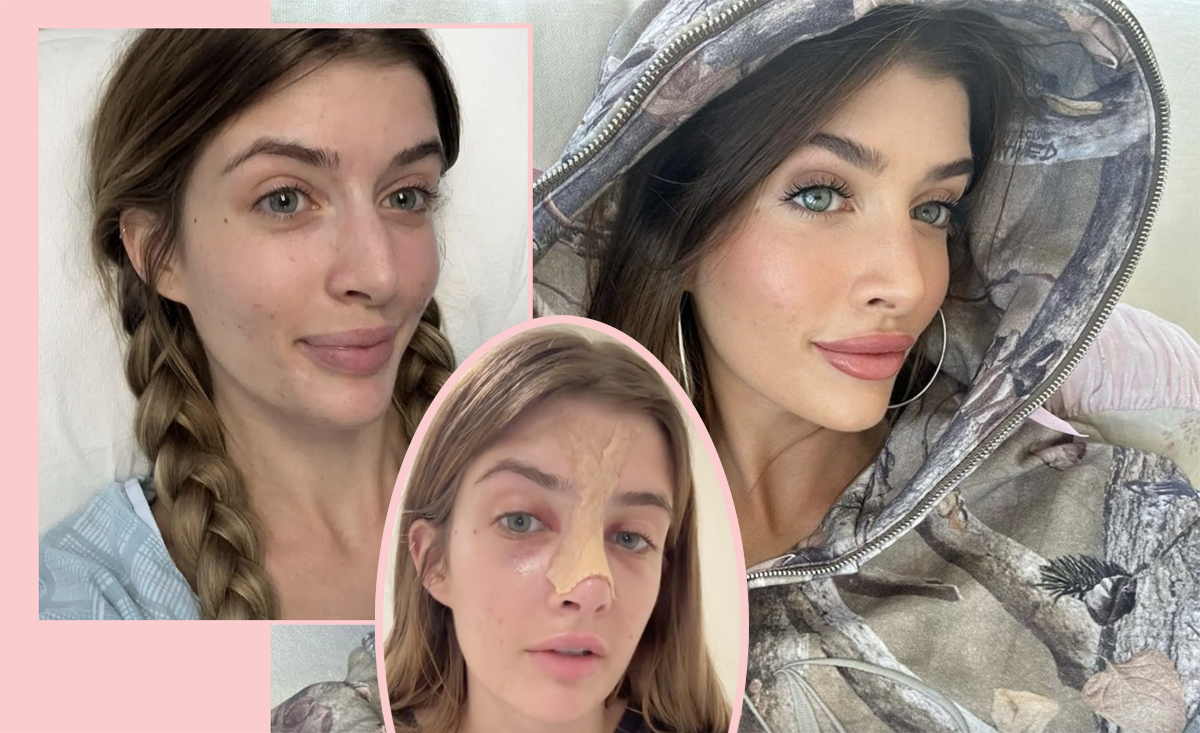 Sami Sheen Says She Was Bullied For Looking Like Her Dad Charlie Before Getting Nose Job!