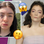Lorde Terrifies Fans By Posting A Series Of Unsettling Black Eye Photos -- And No Explanation!