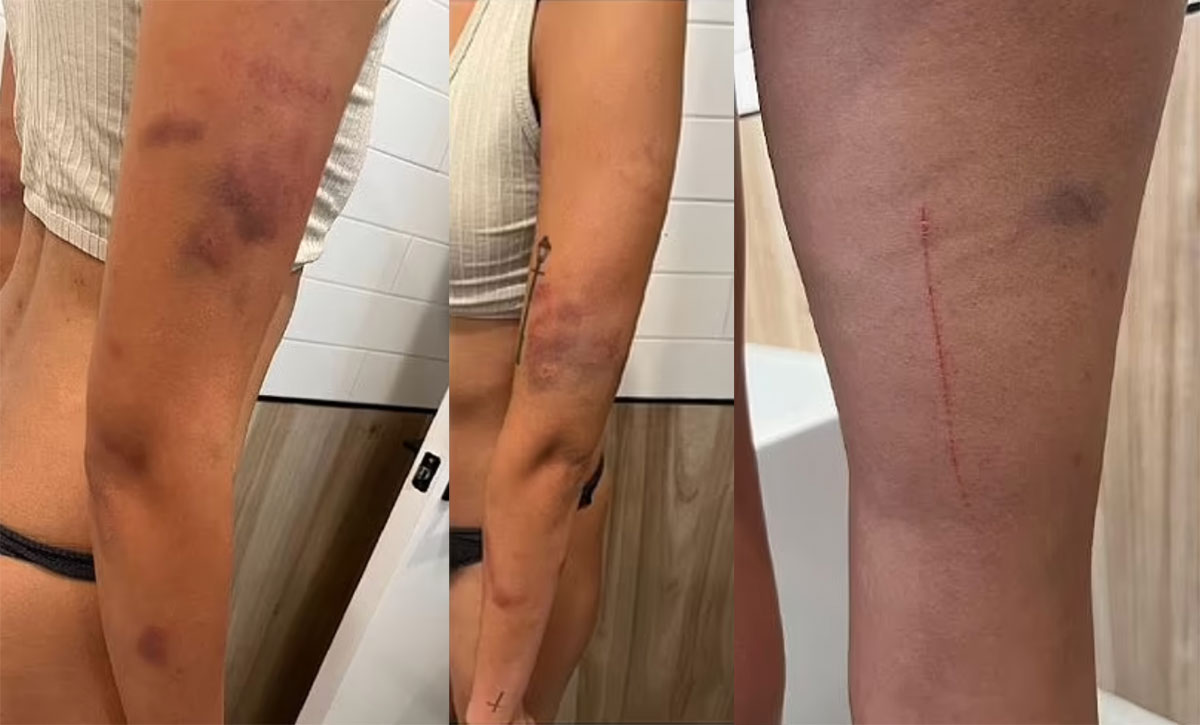 Comedian Sienna Hubert-Ross Accuses Boyfriend Of Abuse, Says He Tried To Suffocate Her In 'Savage' Attack