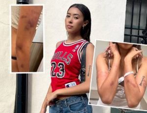 Comedian Sienna Hubert-Ross Accuses Boyfriend Of Abuse, Says He Tried