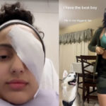 24-Year-Old Loses Eye After Retractable Dog Leash ‘Caved In’ Her Face!
