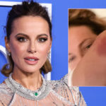 Kate Beckinsale Sparks Fan Concern After Sharing Brutal Injury Pics!