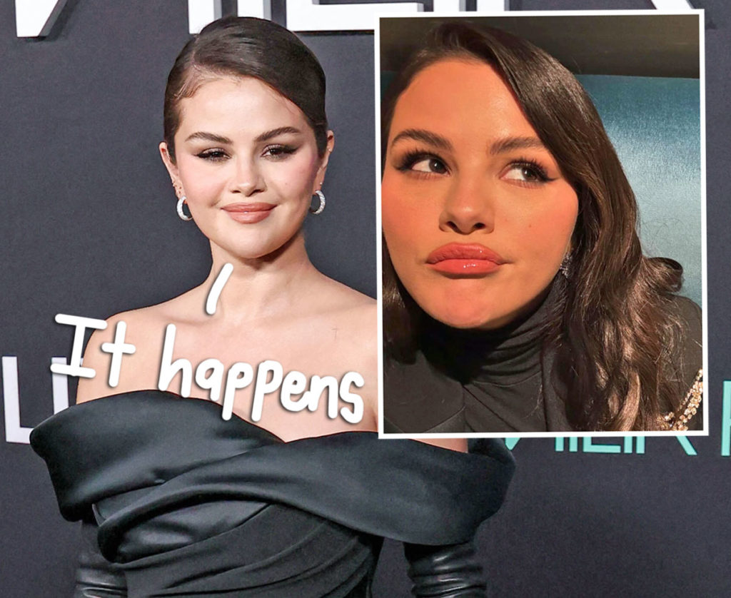 Selena Gomez Shows Off Acne!